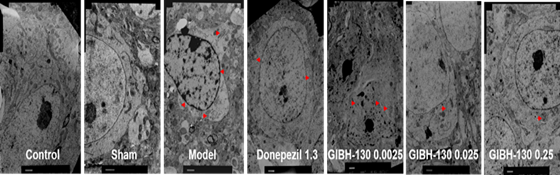 疾病模型小鼠腦部海馬體切片對比圖：口服GIBH-130能夠?qū)ι窠?jīng)元起到保護作用