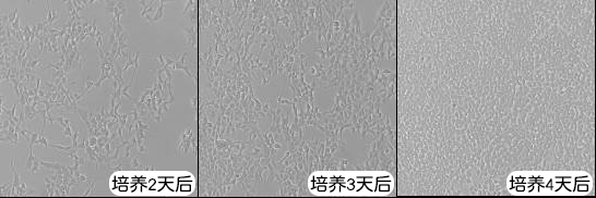 HEK293T細胞培養(yǎng)過程中的不同密度情況